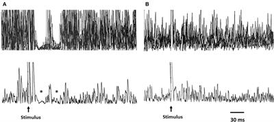 Electrophysiological evidence of subclinical trigeminal dysfunction in patients with COVID-19 and smell impairment: A pilot study